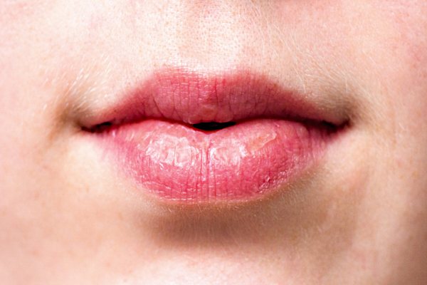 Mundharmonika Ansatz berühmter Spieler Idole Lippen